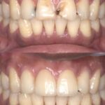 Root Canal Specialist