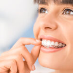 Invisalign Treatment