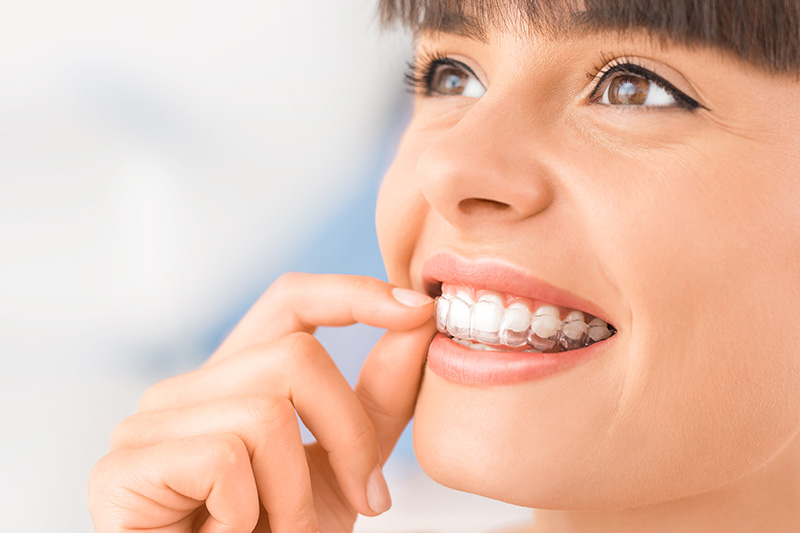 Invisalign Treatment