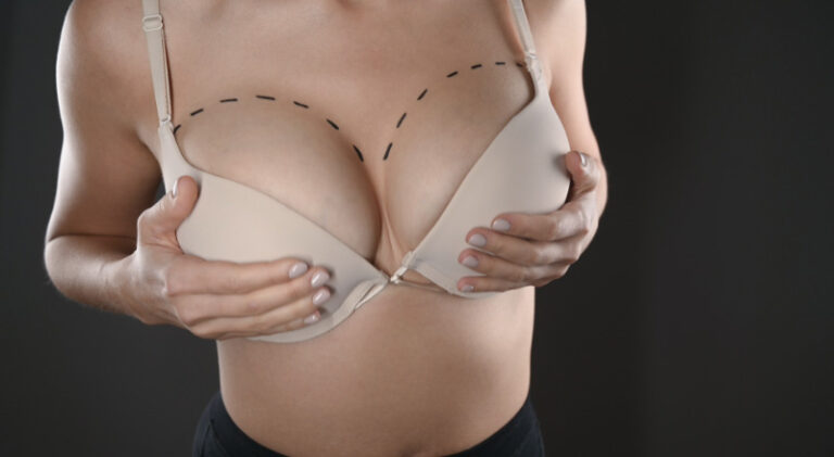 Breast-augmentation-risks
