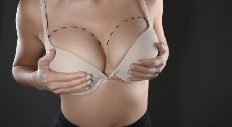 Breast-augmentation-risks