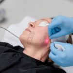 Non-surgical Face Lifting in Dubai