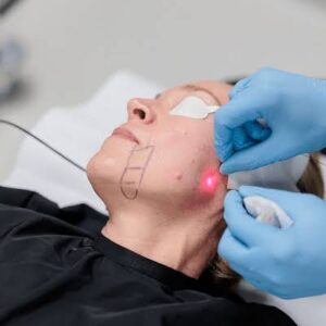 Non-surgical Face Lifting in Dubai