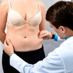 tummy tuck