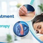 Acupuncture Treatment in Jaipur