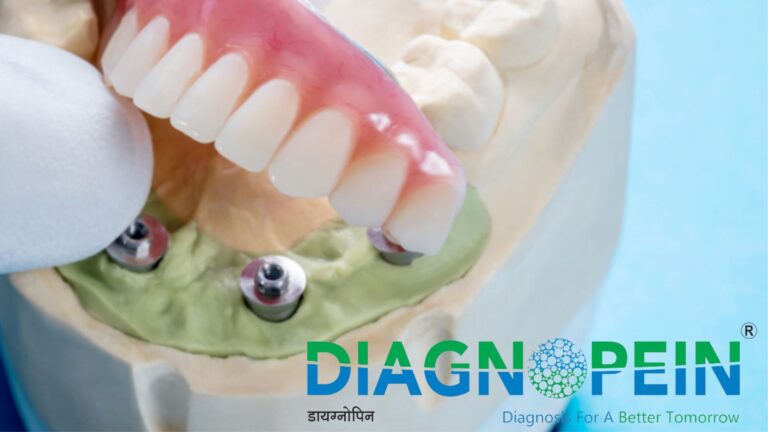Dental Aligners Cost: Clear Aligner Prices & Treatment Details