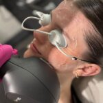ipl skin rejuvenation Edmonton