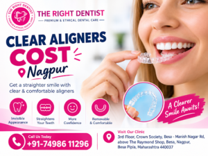 clear aligners cost nagpur