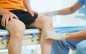 Knee pain treatment
