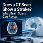 Mini Stroke Recovery Guide (1)