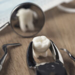 when-is-tooth-extraction-necessary